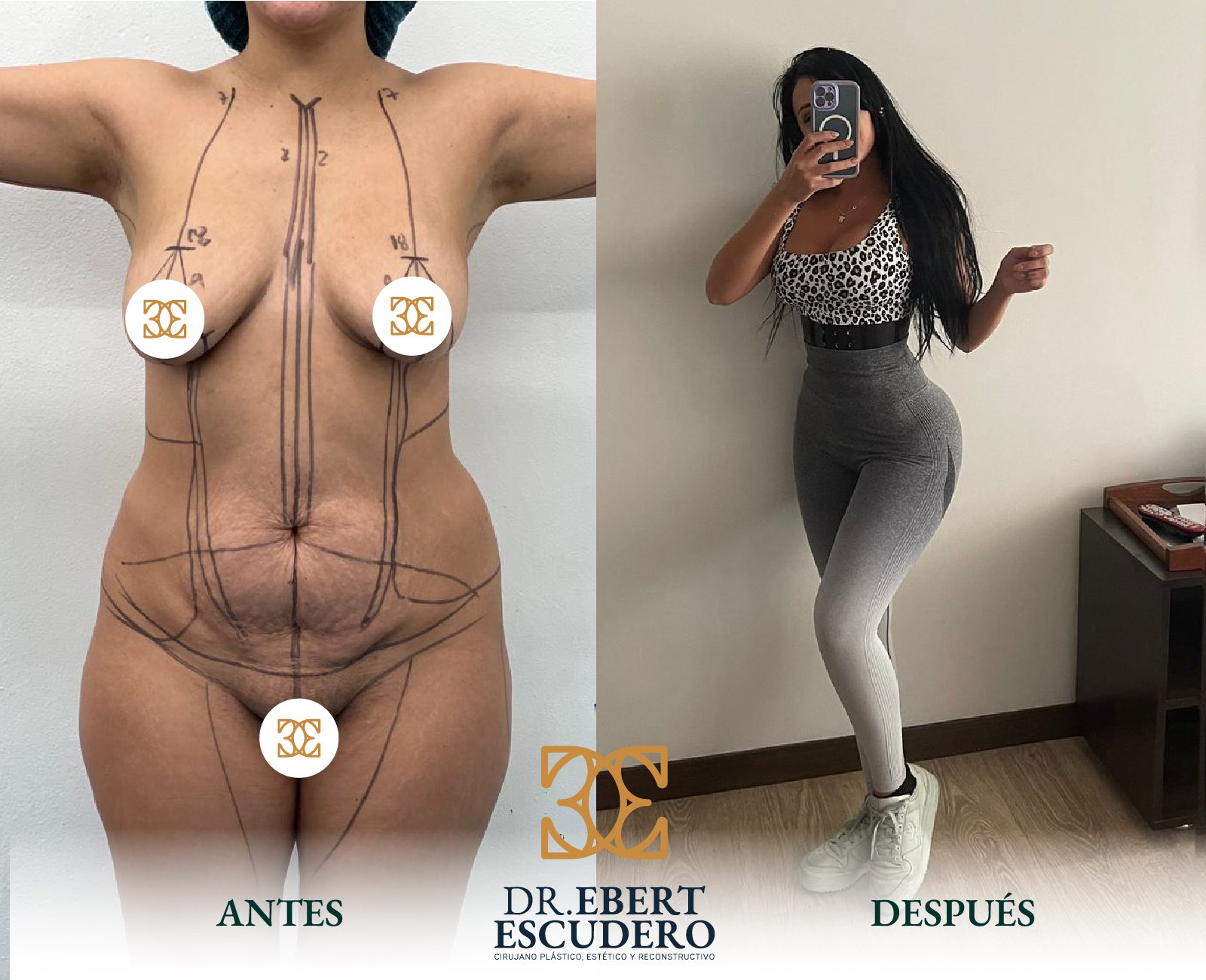 ANTES Y DEPSUES 80-21