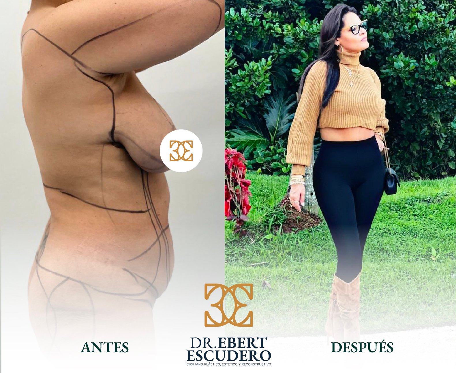 ANTES Y DESPUES NUEVO-65