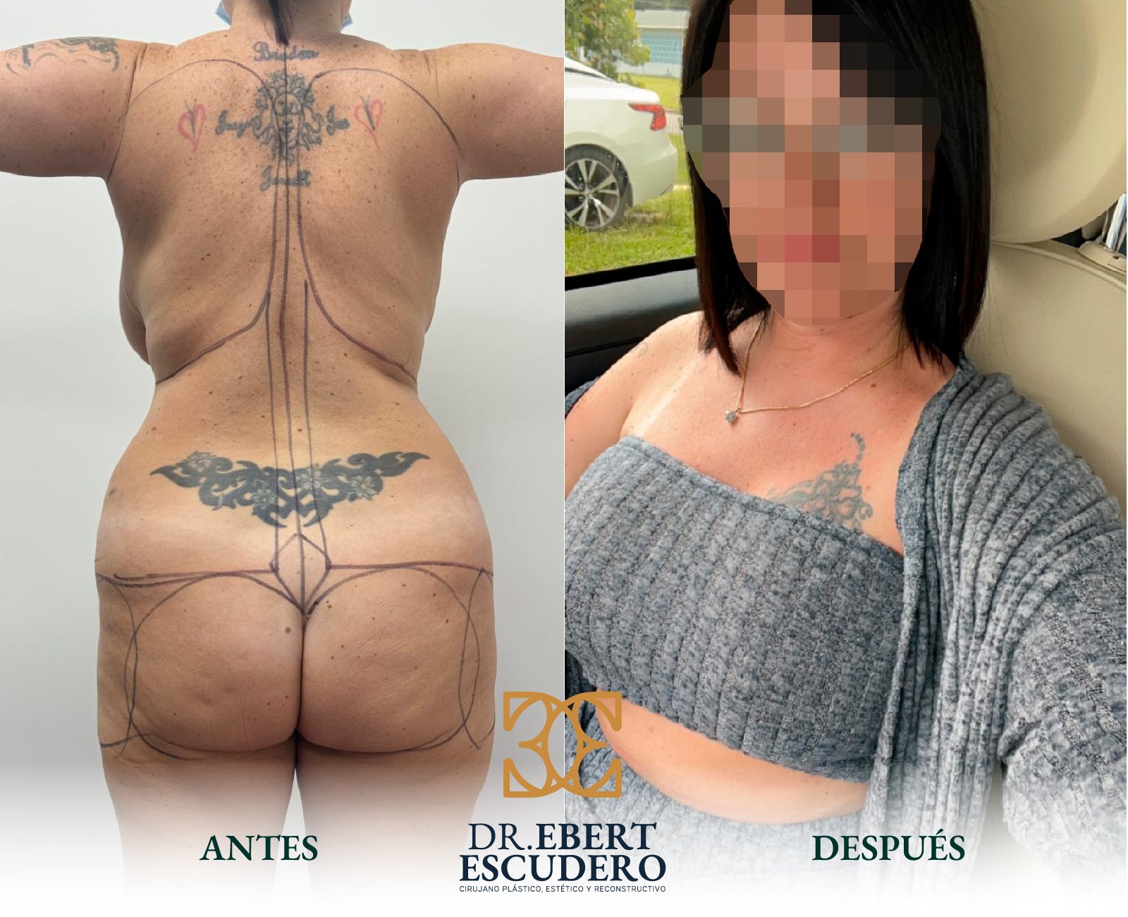 Antes y despues logo nuevo-08
