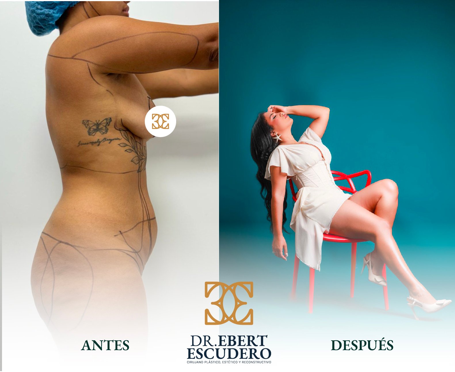 antes y despues -2 nuevo-62